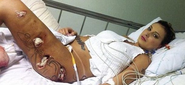 Andressa Urach e il lato B in decomposizione: "Attenti al silicone iniettabile"