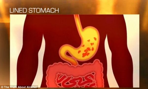 Bere alcol a stomaco vuoto: un video mostra cosa succede nello stomaco