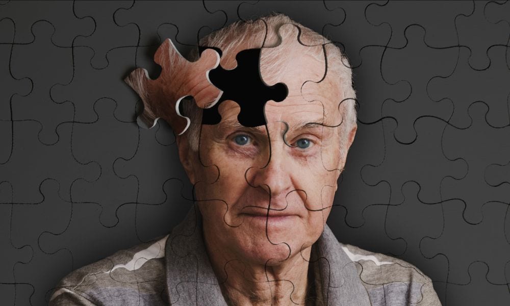L’Alzheimer si trasmette via sangue? I ricercatori lanciano la bomba