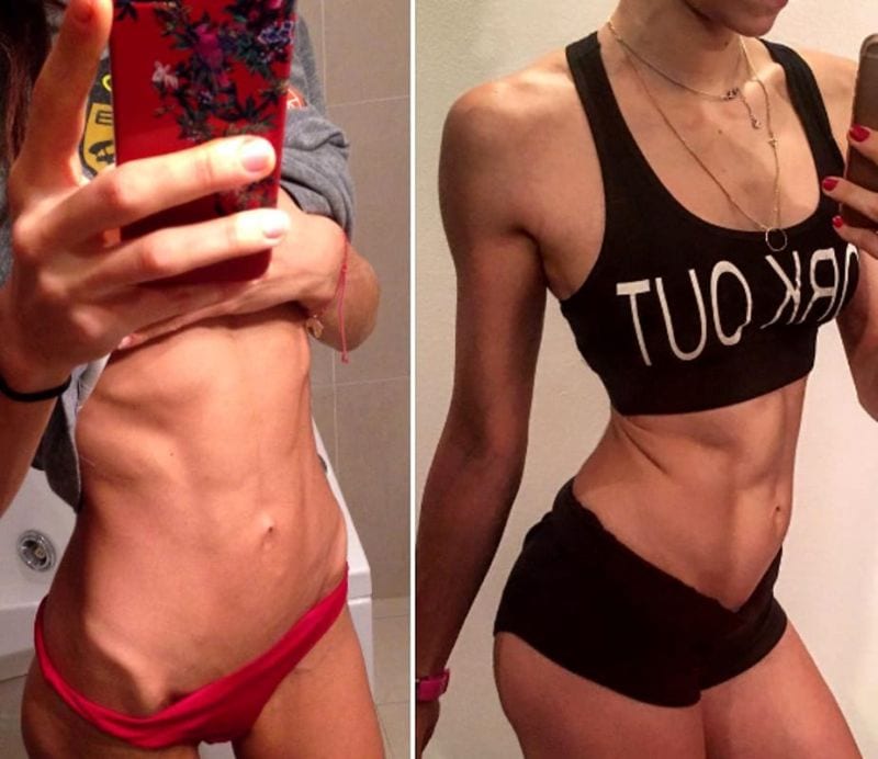 Silvia era anoressica: si è salvata grazie al fitness e ai video su internet