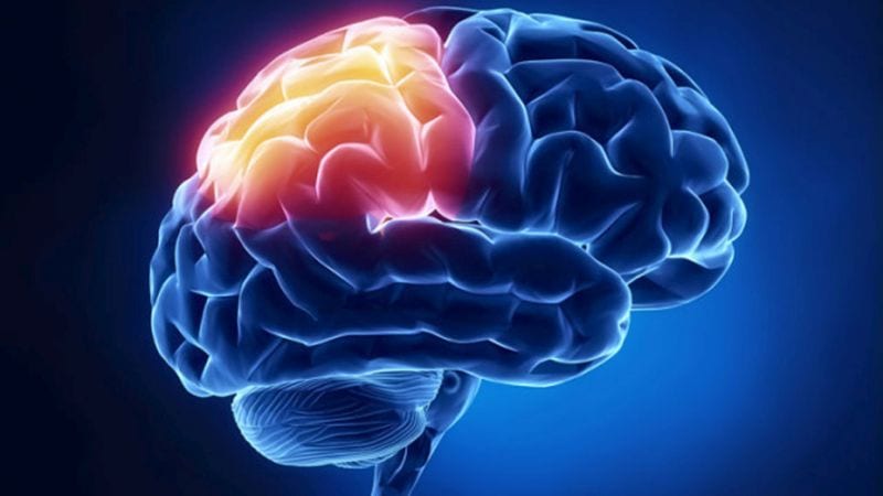 Iniezione di staminali contro l'ictus: i pazienti recuperano i danni al cervello