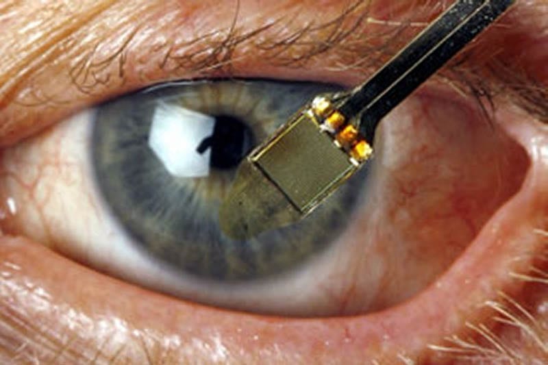 Retina artificiale fa recuperare la vista: sull'uomo entro il 2017
