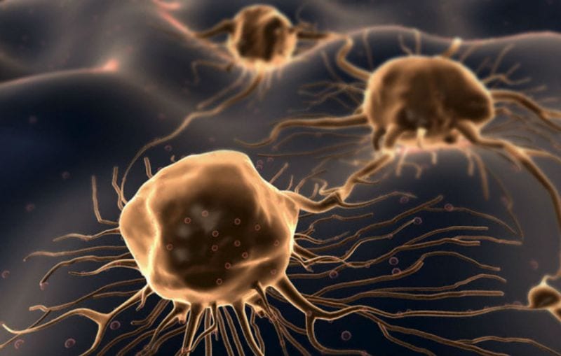 Tumore: una nuova terapia colpisce solo le cellule cattive