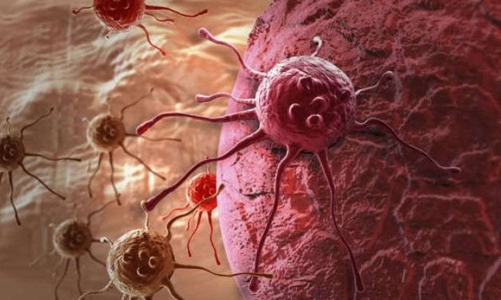 Tumore: una nuova terapia colpisce solo le cellule cattive
