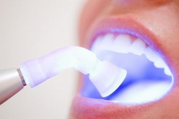Sbiancamento denti: l'uso del led