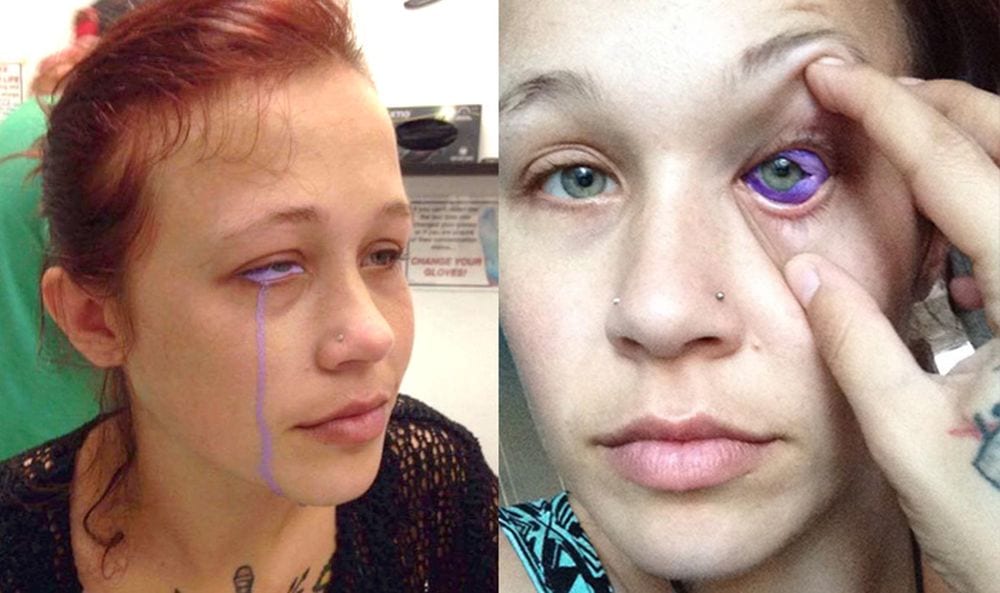 Tatuaggio sulla cornea: modella di 24 anni rischia di perdere la vista