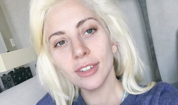Lady Gaga e fibromialgia: "Il dolore cronico che mi ha cambiato la vita"