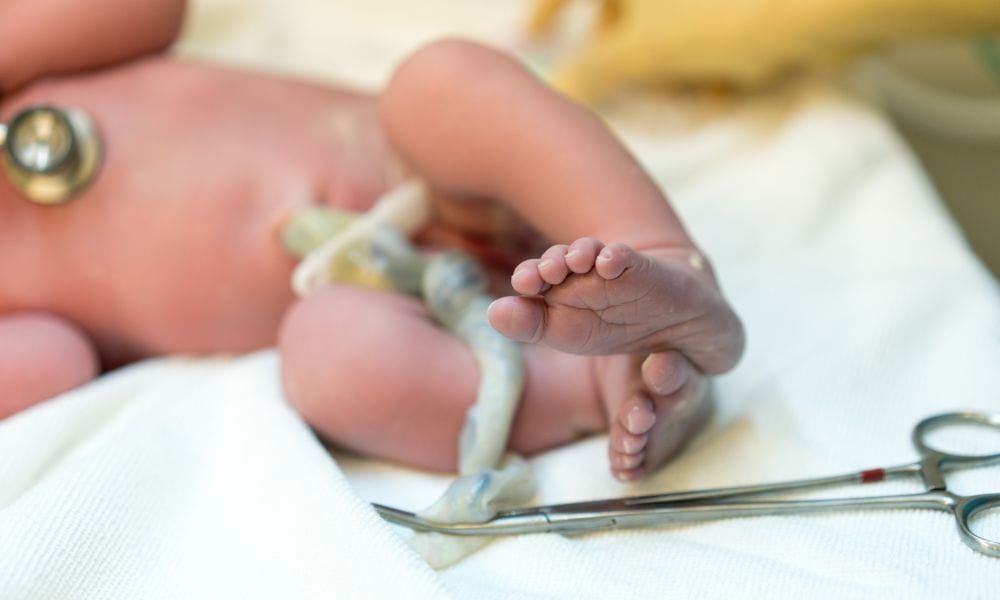 Lotus birth durante il parto: cos’è, perché preoccupa i medici