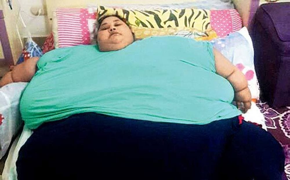 Morta la donna più grassa del mondo: era scesa da 500 a 254 kg
