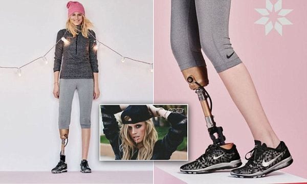 Modella perde una gamba: il tampax le causa uno shock tossico