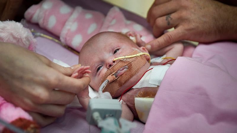 Nasce con il cuore fuori dal petto: come sta la neonata dopo 3 interventi