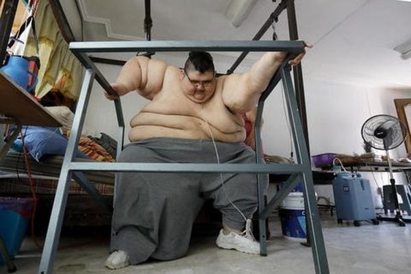 L'uomo più grasso del mondo è dimagrito 250 chili: com'è diventato