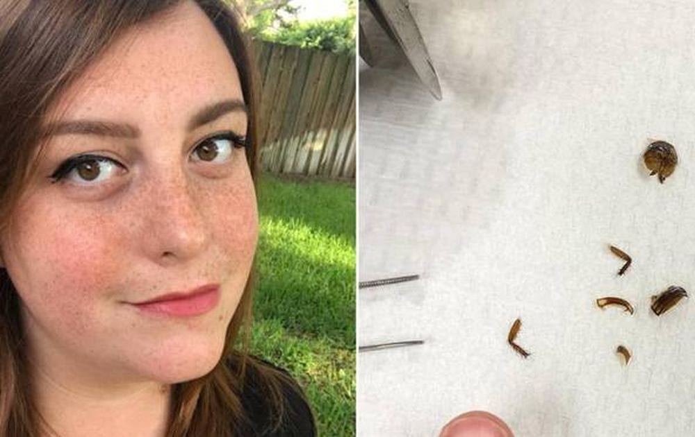 Rimane con uno scarafaggio nell’orecchio per 9 giorni: i suoi problemi non finiscono lì