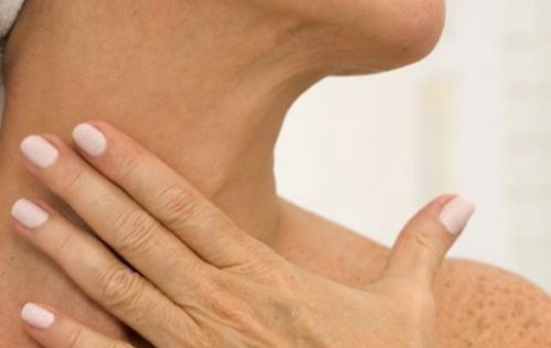 Rughe del collo: meglio prevenire che curare. Parola dell'Estetista Cinica