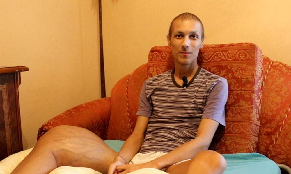 Muore Luca Cardillo: purtroppo ha vinto il suo osteosarcoma alla gamba