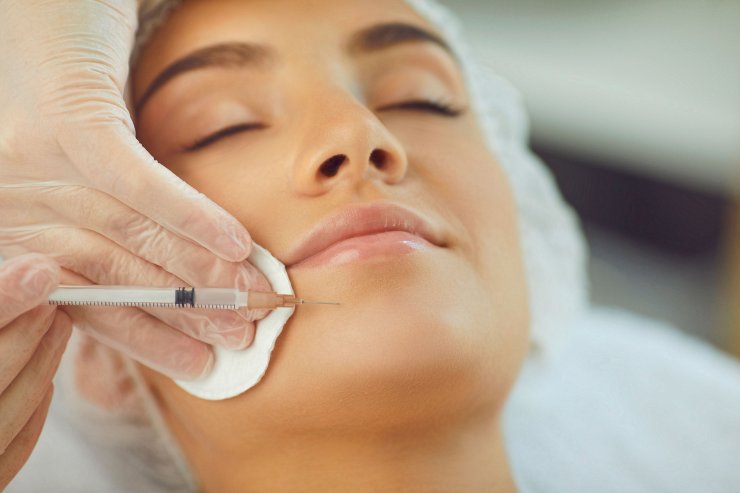 Baby botox: in cosa consiste