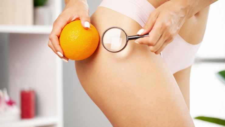 Cellulite rimedi sintomi