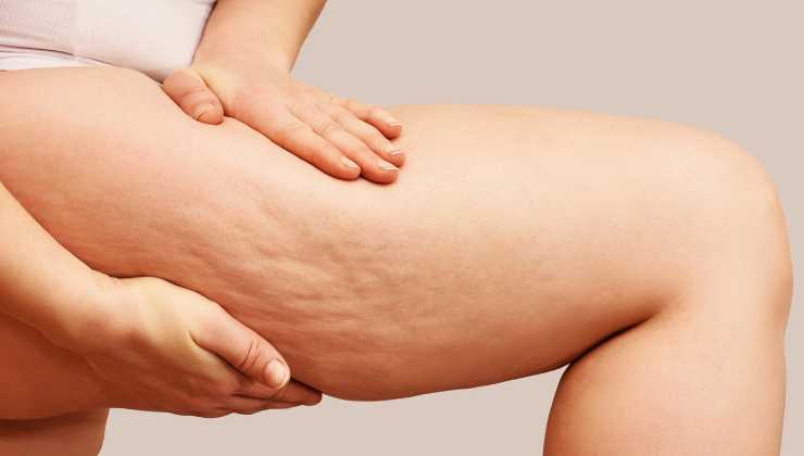 cellulite quali alimenti mangiare