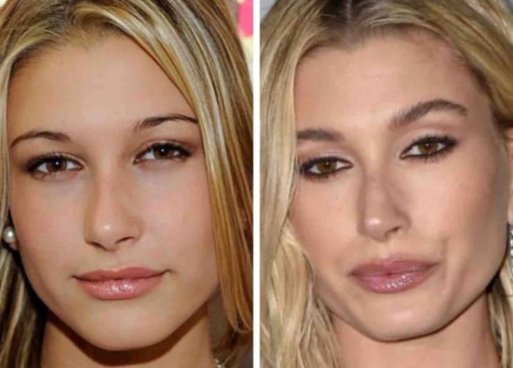 Hailey Bieber prima e dopo il successo